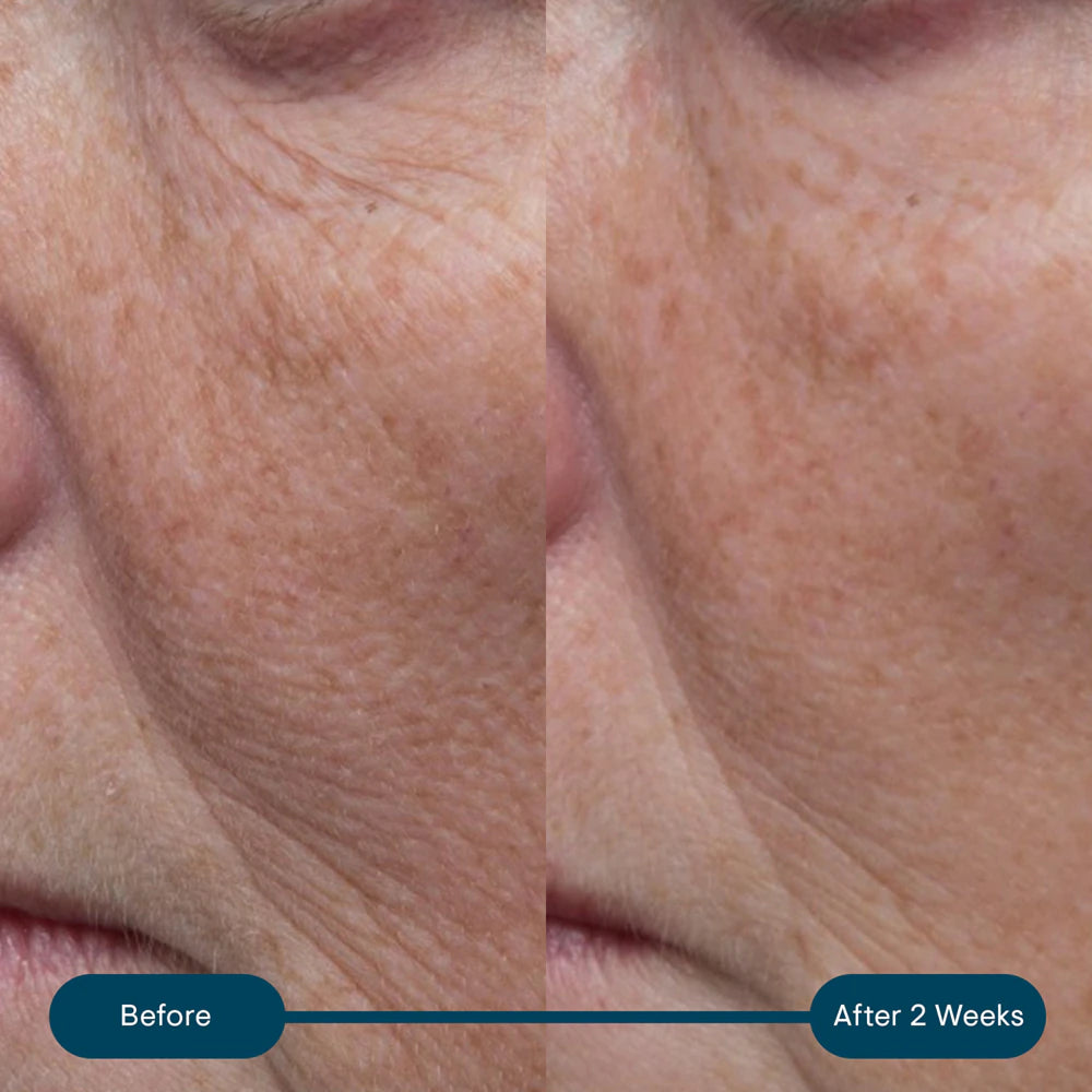 Elemis Pro-Collagen